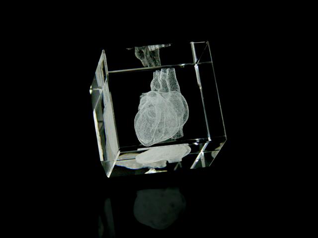 Crystal Heart (Medical)
